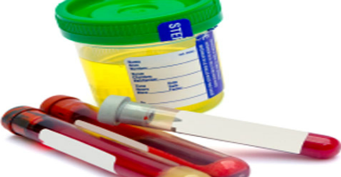 urine sample container and test tubes